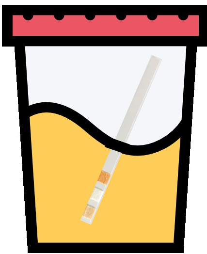 Dépistage de l'infection urinaire par la bandelette urinaire